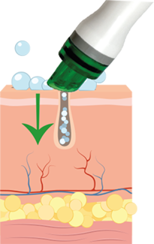 Preview: HydrO2 Glow 4-in-1