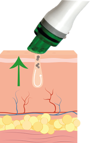 Preview: HydrO2 Glow 4-in-1