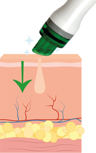 Preview: HydrO2 Glow 4-in-1